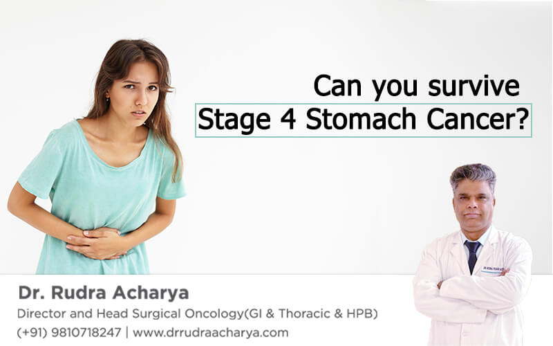 stage 4 stomach cancer treatment in Delhi